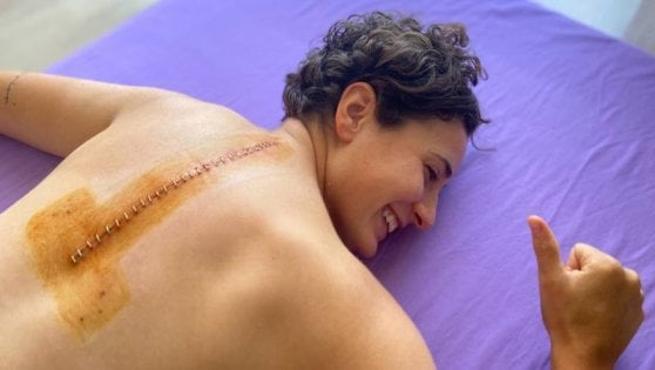 Ana Carrasco operazione alla schiena